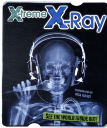 Image for X-Treme X-Ray