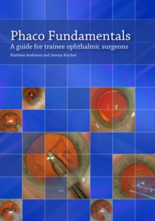 Image for Phaco fundamentals  : a guide for trainee ophthalmic surgeons