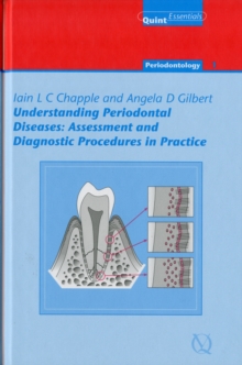 Image for Understanding periodontal diseases  : assessment and diagnostic procedures in practice