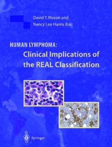 Image for Human Lymphoma: Clinical Implications of the Real Classification