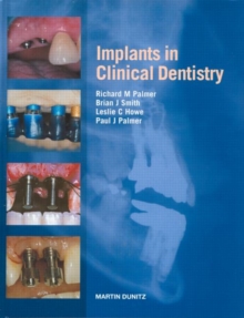 Image for Implants in clinical dentistry