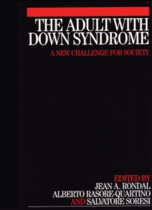 Adult with Down Syndrome