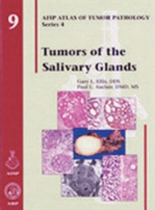 Tumors of the Salivary Glands