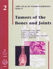 Tumors of the Bones and Joints