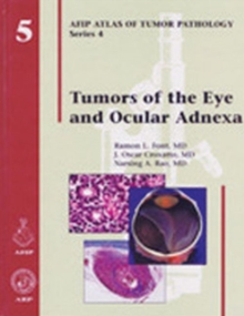 Tumors of the Eye and Ocular Adnexa