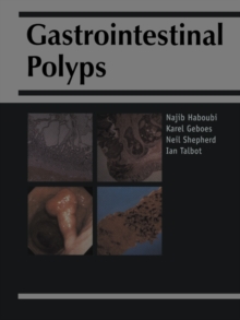 Image for Gastrointestinal Polyps