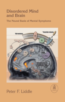 Image for Disordered mind and brain