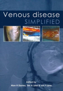 Image for Venous Disease Simplified