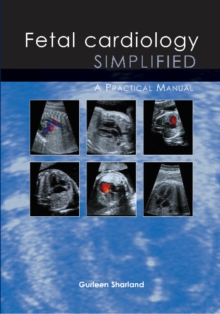 Fetal Cardiology Simplified: A Practical Manual