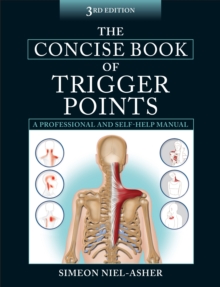 The Concise Book of Trigger Points