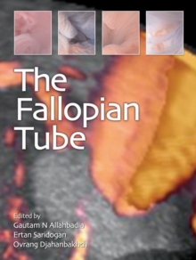 Image for The Fallopian Tube