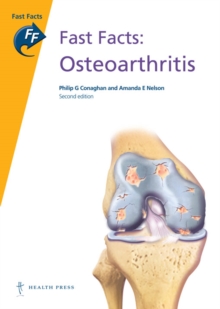 Image for Fast Facts: Osteoarthritis