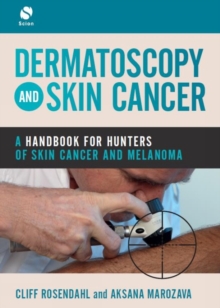Image for Dermatoscopy and Skin Cancer: A handbook for hunters of skin cancer and melanoma