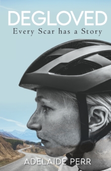 Image for Degloved : Every Scar has a Story