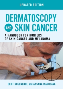 Image for Dermatoscopy and skin cancer  : a handbook for hunters of skin cancer and melanoma
