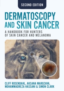 Image for Dermatoscopy and Skin Cancer, second edition