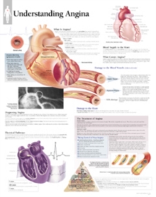 Image for Understanding Angina Paper Poster