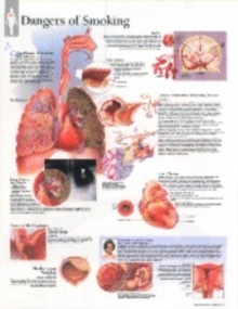 Effects of Smoking Laminated Poster