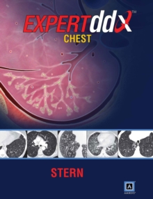 Image for EXPERTddx: Chest