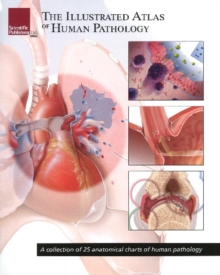 Image for Illustrated atlas of human pathology  : a collection of 25 anatomical charts of human pathology