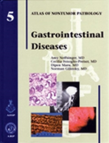 Image for Gastrointestinal Diseases