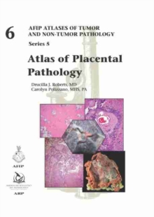 Image for Atlas of Placental Pathology