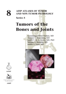 Image for Tumors of the bones and joints