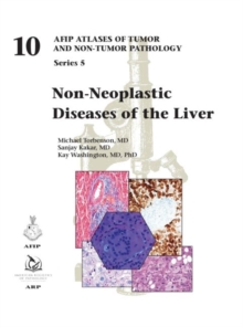 Non-Neoplastic Diseases of the Liver