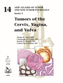 Image for Tumors of the cervix, vagina, and vulva