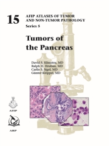 Image for Tumors of the pancreas