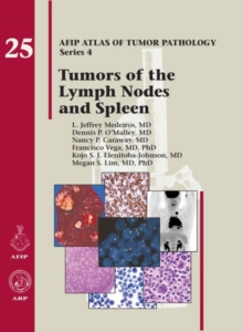 Image for Tumors of the Lymph Nodes and Spleen