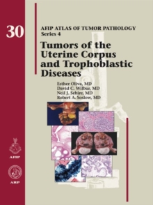 Image for Tumors of the Uterine Corpus and Trophoblastic Diseases