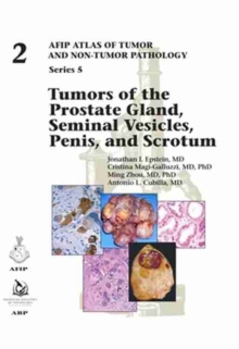 Image for Tumors of the Prostate Gland, Seminal Vesicles, Penis, and Scrotum
