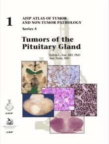 Image for Tumors of the Pituitary Gland