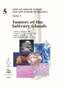 Image for Tumors of the Salivary Glands