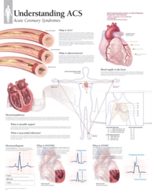 Understanding ACS (Acute Coronary Syndrome) Laminated Poster ...