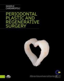 Image for Periodontal Plastic and Regenerative Surgery