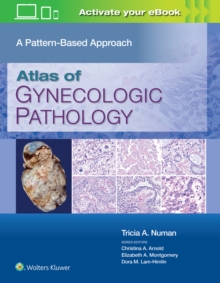 Atlas of Gynecologic Pathology: A Pattern-Based Approach: Print + eBook with Multimedia