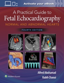 Image for A practical guide to fetal echocardiography  : normal and abnormal hearts
