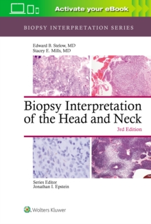 Biopsy Interpretation of the Head and Neck