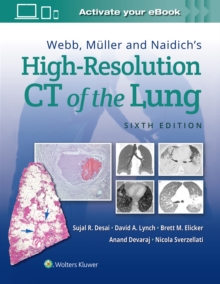 Image for Webb, Muller and Naidich's High-Resolution CT of the Lung
