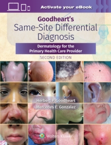 Goodheart’s Same-Site Differential Diagnosis: Dermatology for the Primary Health Care Provider