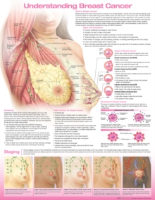 Image for Understanding Breast Cancer Anatomical Chart