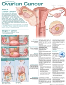 Image for Understanding Ovarian Cancer Anatomical Chart