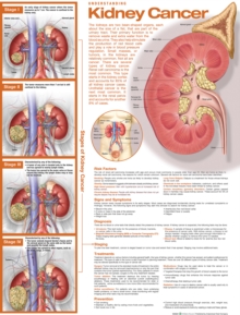 Image for Understanding Kidney Cancer Anatomical Chart