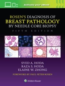 Image for Rosen's Diagnosis of Breast Pathology by Needle Core Biopsy