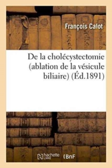 Image for de la Chol?cystectomie Ablation de la V?sicule Biliaire