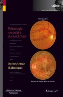 Image for Pathologie vasculaire du fond d'oeil [electronic resource] : (en dehors du diabète) / sous le direction de Alain Gaudric.