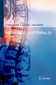 Image for Metastases Vertebrales