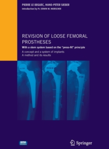 Image for Revision of loose femoral prostheses with a stem system based on the "press-fit" principle : A concept and its system of implants, a method and its results